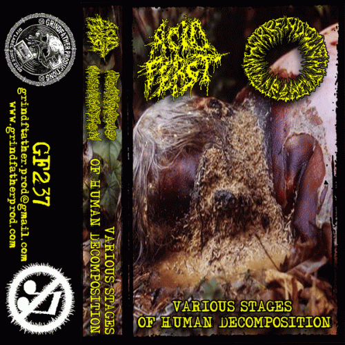 Acid Feast : Various Stages of Human Decomposition
